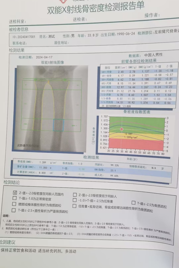 雙能X射線骨密度儀：準(zhǔn)確測(cè)量骨密度，助力骨質(zhì)疏松防治，守護(hù)骨骼健康